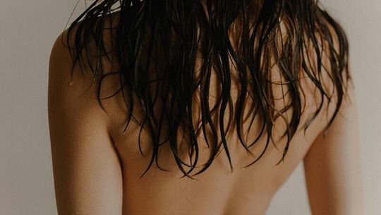 Cienka i wrażliwa skóra głowy – wina łuszczycy?